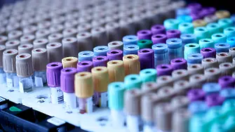 Проф. Хинков: Не се обсъжда таван на заплатите в държавните болници