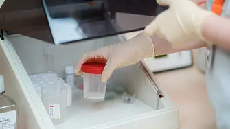 Българска асоциация по лабораторна и клинична андрология ще бъде учредена в рамките на Първата национална конференция по мъжко репродуктивно здраве в Плевен